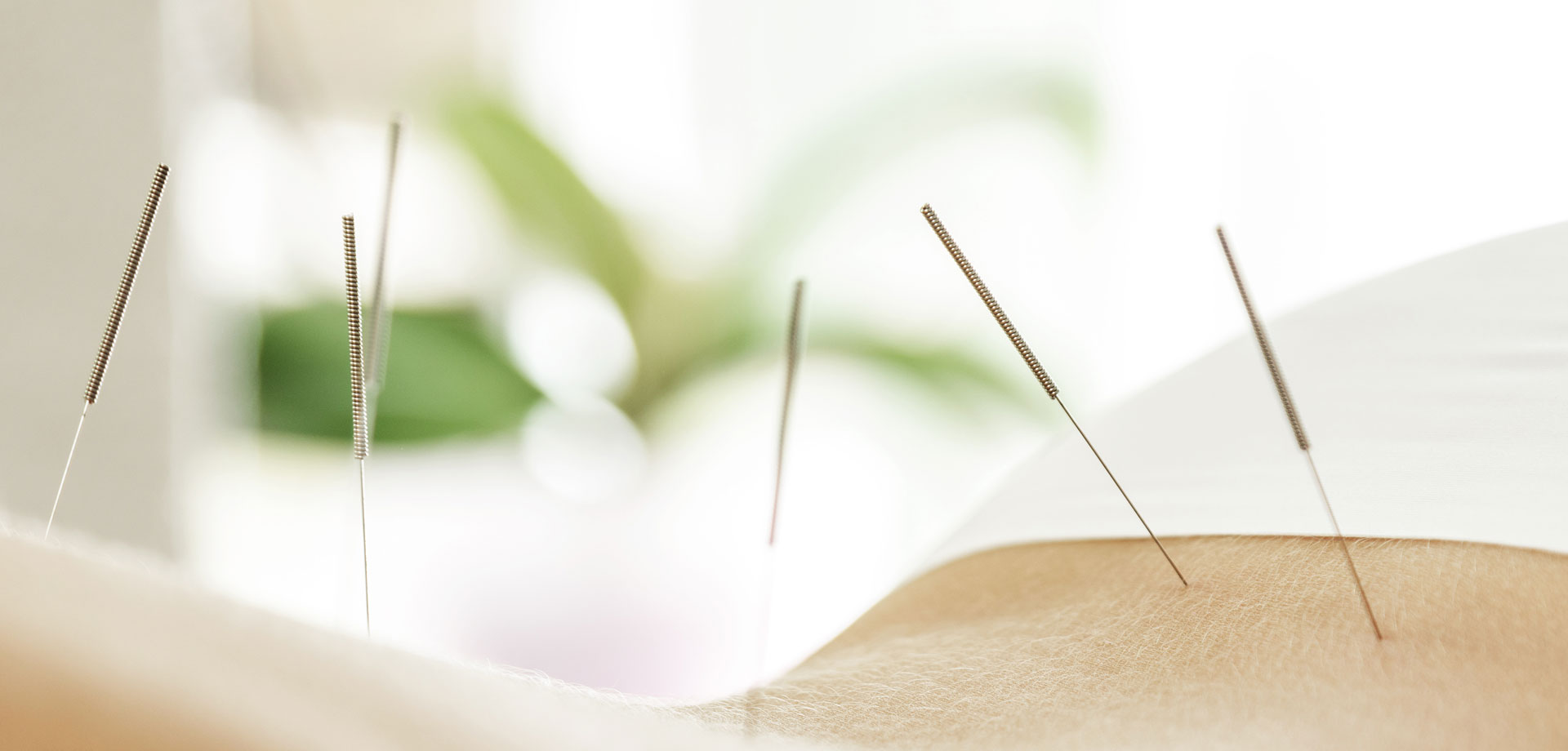 Acamtherapy – Shiatsu + Acupuncture